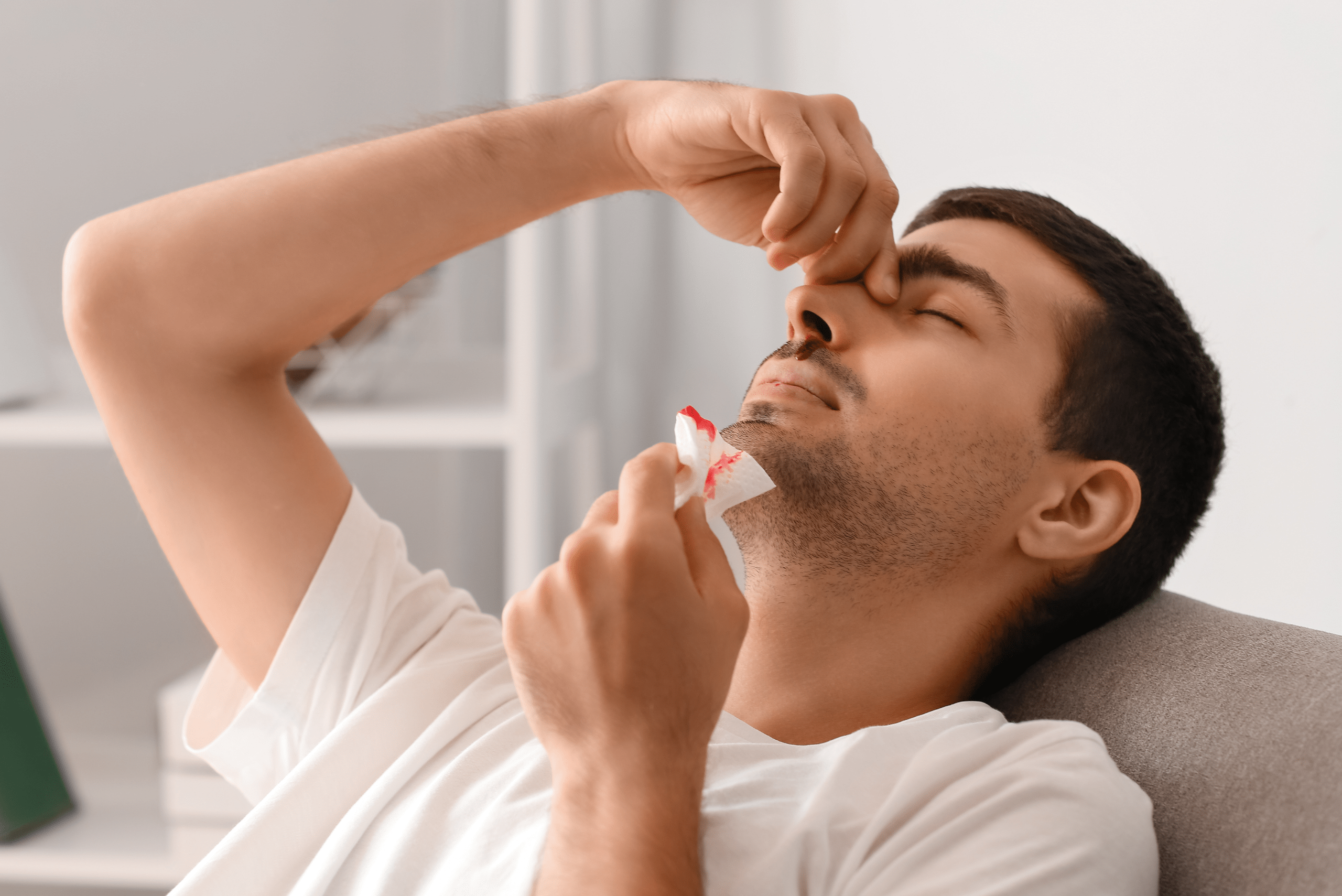 Man leaning head back with a nosebleed.