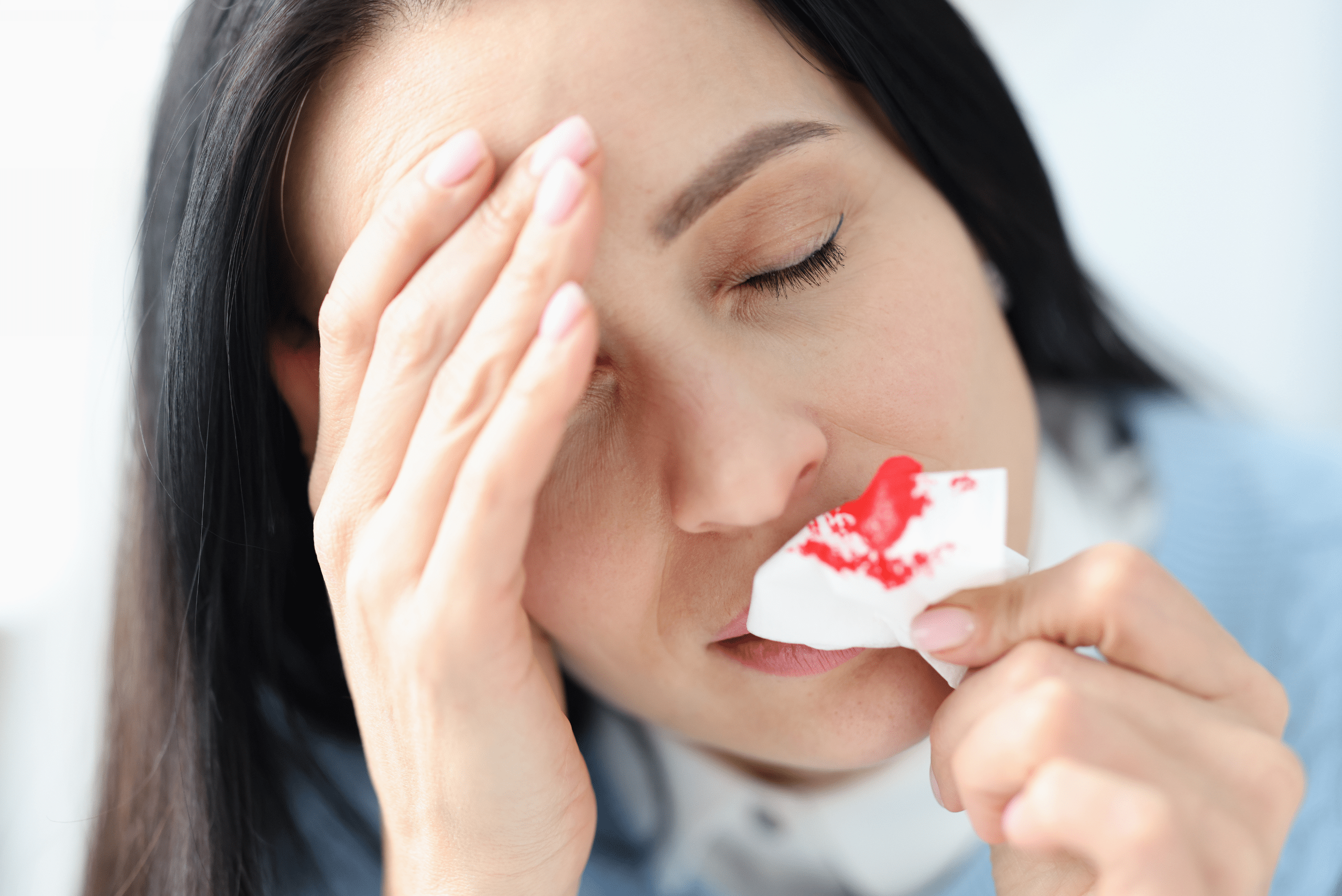 Woman leaning head back with a nosebleed.